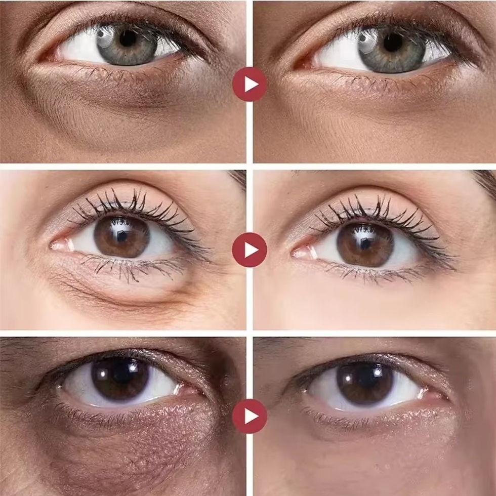 Miniatura: Rolon 5 em 1 Ultra Rejuvenescedor - Luteína Glow®