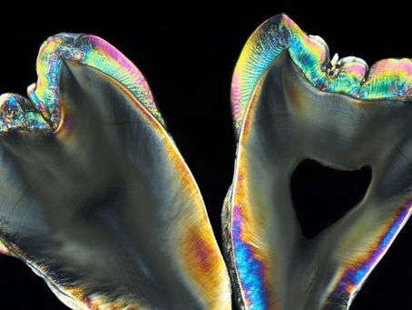 歯の薄片の写真を撮ろう