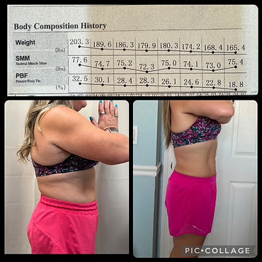 Before & after weight loss of woman