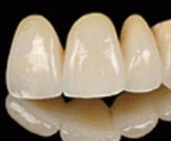 corona zirconio, economicas, excelente calidad, prefesional