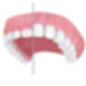 gum-contouring.jpg