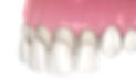 veneers.jpg