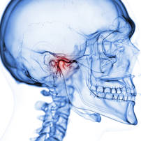 Oro-facial pain and TMD