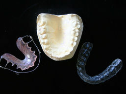 WHAT TO DO IF YOUR RETAINER DOESN'T FIT ANYMORE