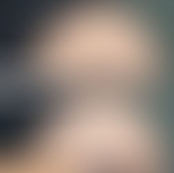 前額部 PRPF®︎ 注入療法