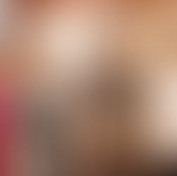 2021年11月17日 PRPF®︎ ワークショップ @ジョイアクリニック京都