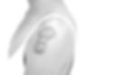 keloid.jpg