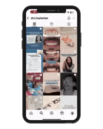 POSTS-BLANC-2025-1--unscreen.gif