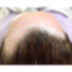 Kopfhautpigmentation München