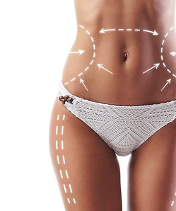 prezzo-liposuzione-bodytite.jpeg