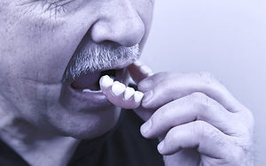 man removing dentures
