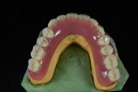 Prothèse dentaire complète sur modèle