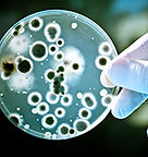 Bacteria