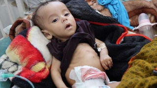 Yemen: Ayuda humanitaria de ONU a Yemen contenía comida podrida