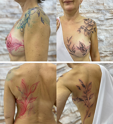 tatouage sur cicatrices étapes