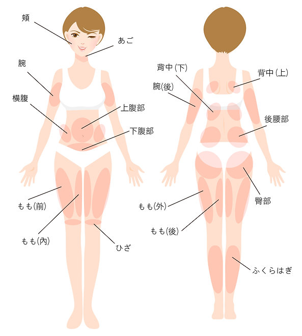 日文官網_服務項目_皮下減脂_身體圖.jpg