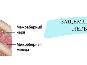 Симптомы межрёберной невралгии