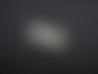 Is Acid Reflux Different for Men and Women? Understanding the Gender-Based Differences