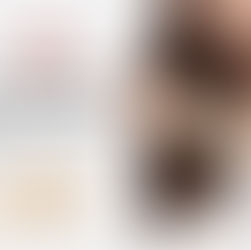 Dry Fruits for Hair Growth: Benefits of Cashews, Almonds & Makhana