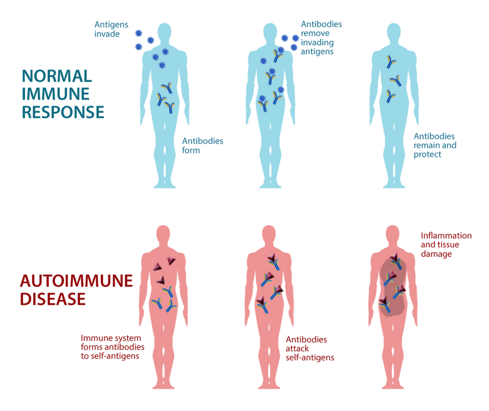 Autoimmune Disease Awareness Month autoimmune-disease-awareness-month