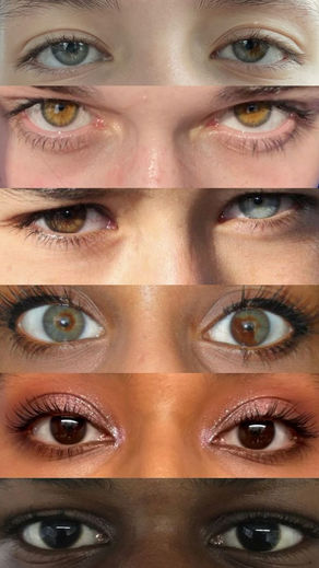 Protecting Your Eyes