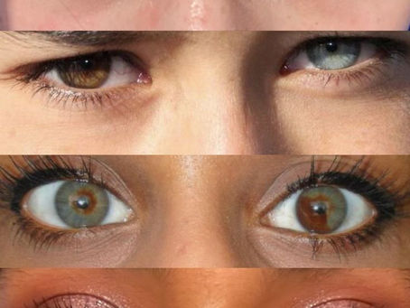 Protecting Your Eyes