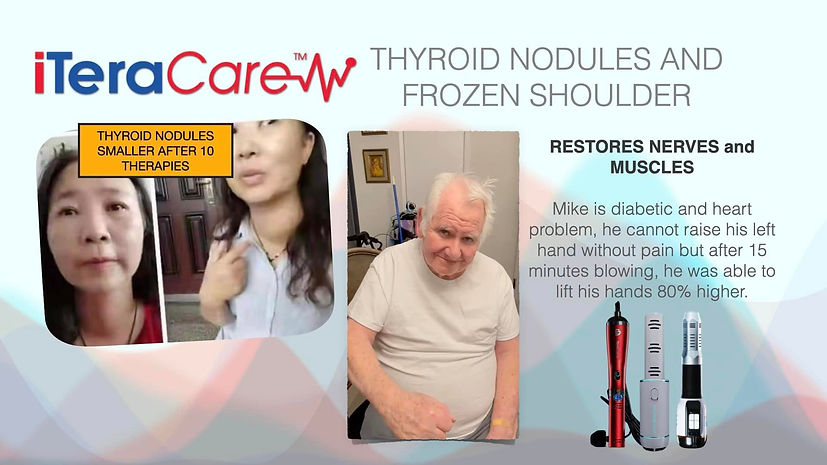 Use the iTera Frequency Wand to help with frozen shoulder