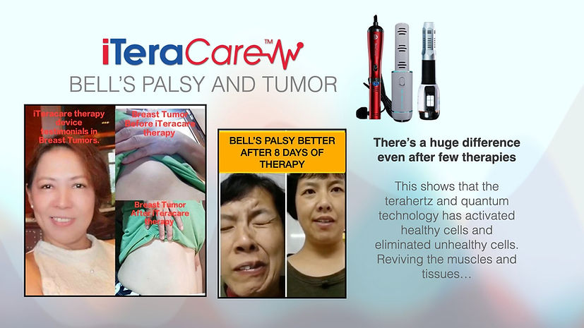 The iTeraCare wand has been used to help with Bells Palsy