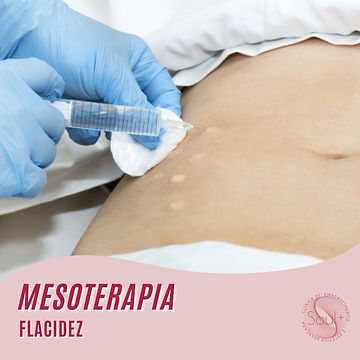 2_Mesoterapia flacidez.jpeg
