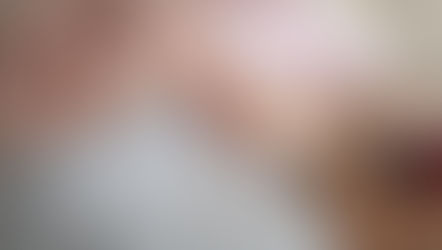 Spinal Musküler Atrofi (SMA) Hastalığı Nedir? Tedavi Yöntemleri Nelerdir?