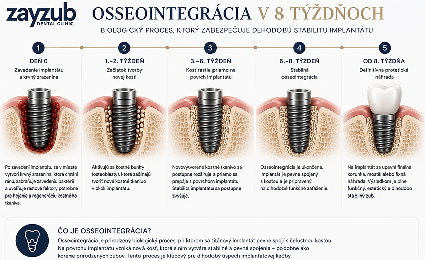 Osseointegracia implantatov