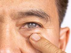 Rozlúčte sa so zahmleným videním - operácia sivého zákalu zaručí nový zrak