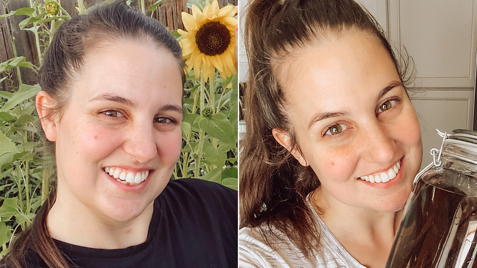 2 week change with intentional lymphatic drainage - no other changes were made! Swollen face to slim and less inflammation.