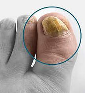 THICK NAIL.jpg