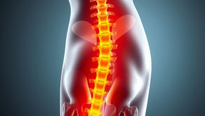 What Causes Sciatica? Common Symptoms and Treatment