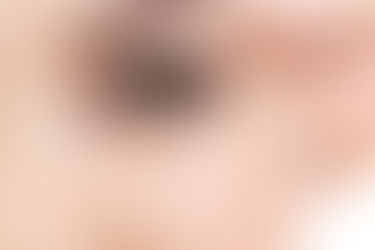 SURGERY-FREE EYEBROW LIFT