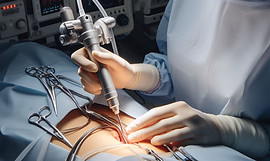 Discover the power of laparoscopy at Girivar Hospital in Lonaval. Experience advanced surgical techniques for optimal results