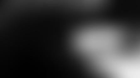 El daño cerebral que no sale en la imagen: TC normal, vida alterada