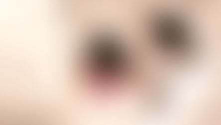 El Derecho al tratamiento neurorehabilitador inmediato tras el alta Hospitalaria en el daño cerebral por accidentes de tráfico