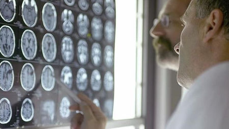 El protocolo ictus y su cumplimiento