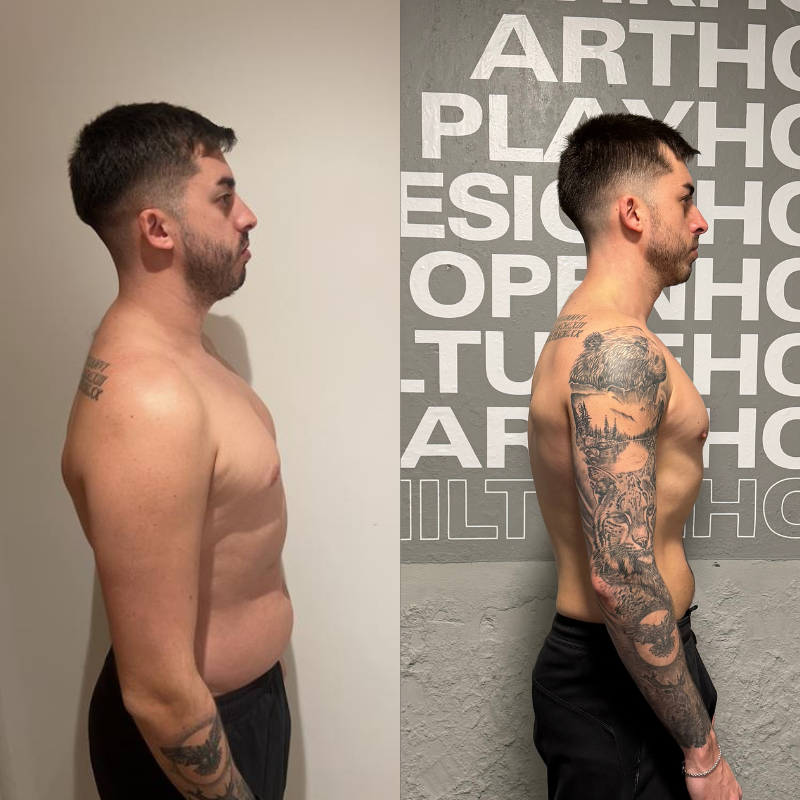 5 Common Fat Loss Mistakes That Hold You Back
