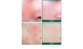 Thumbnail: №18 AHA.BHA.PHA 30 days miracle starter Батганы ком