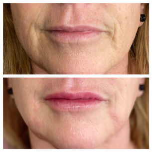 Facetune_08-02-2022-12-04-52 2.JPG