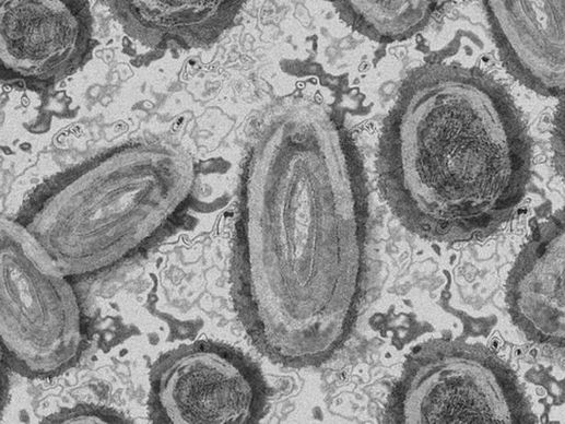 Vaiolo delle scimmie: l’Europa è l’epicentro di questa ondata di diffusione del virus