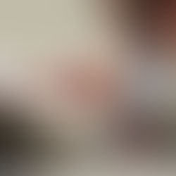 Tác Động Nguy Hiểm của Hội Chứng Suy Giảm Miễn Dịch ở Mèo (FIV): Mối Lo Ngập Tràn và Cách Phòng Tránh