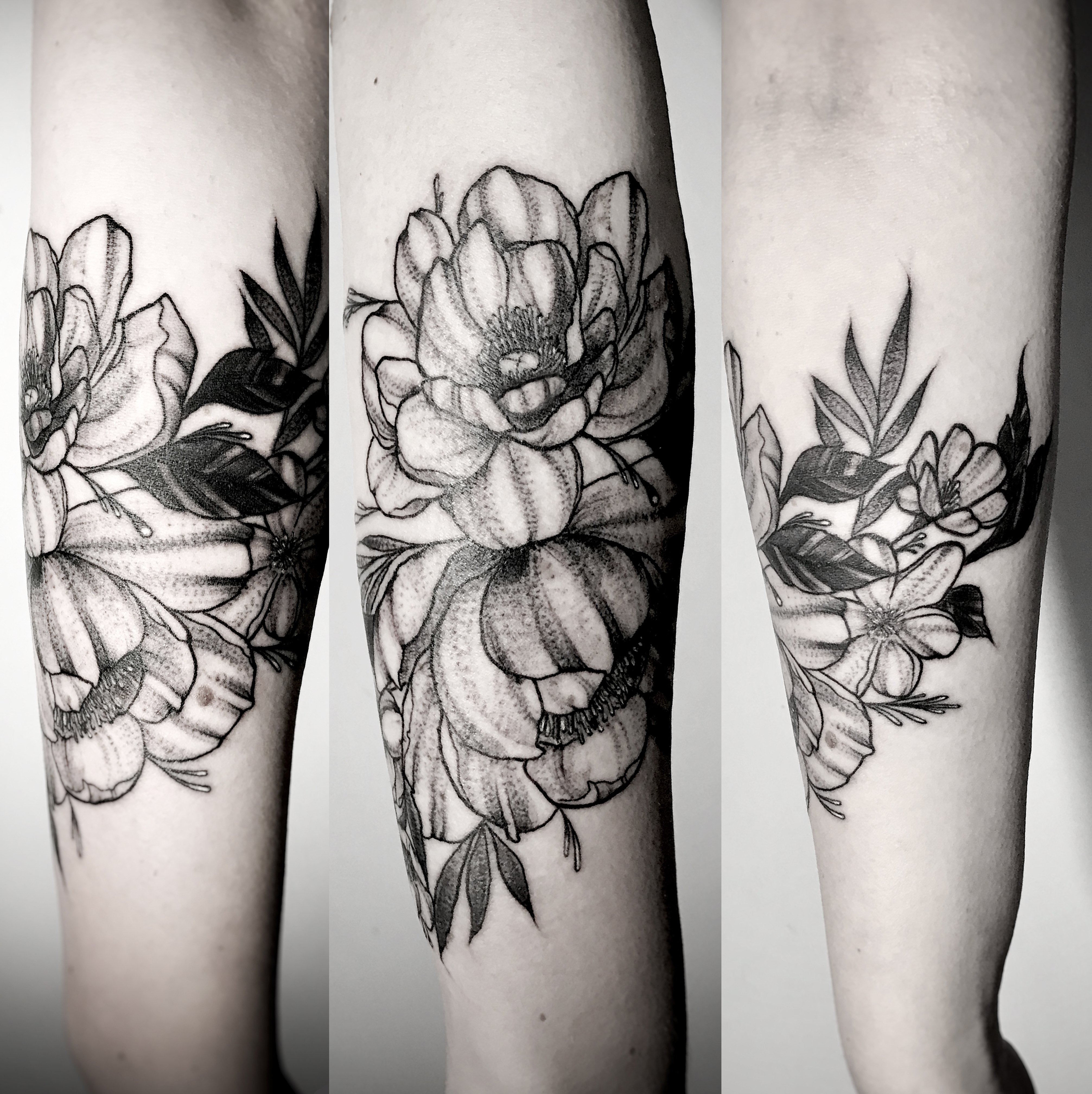 Peonias arm