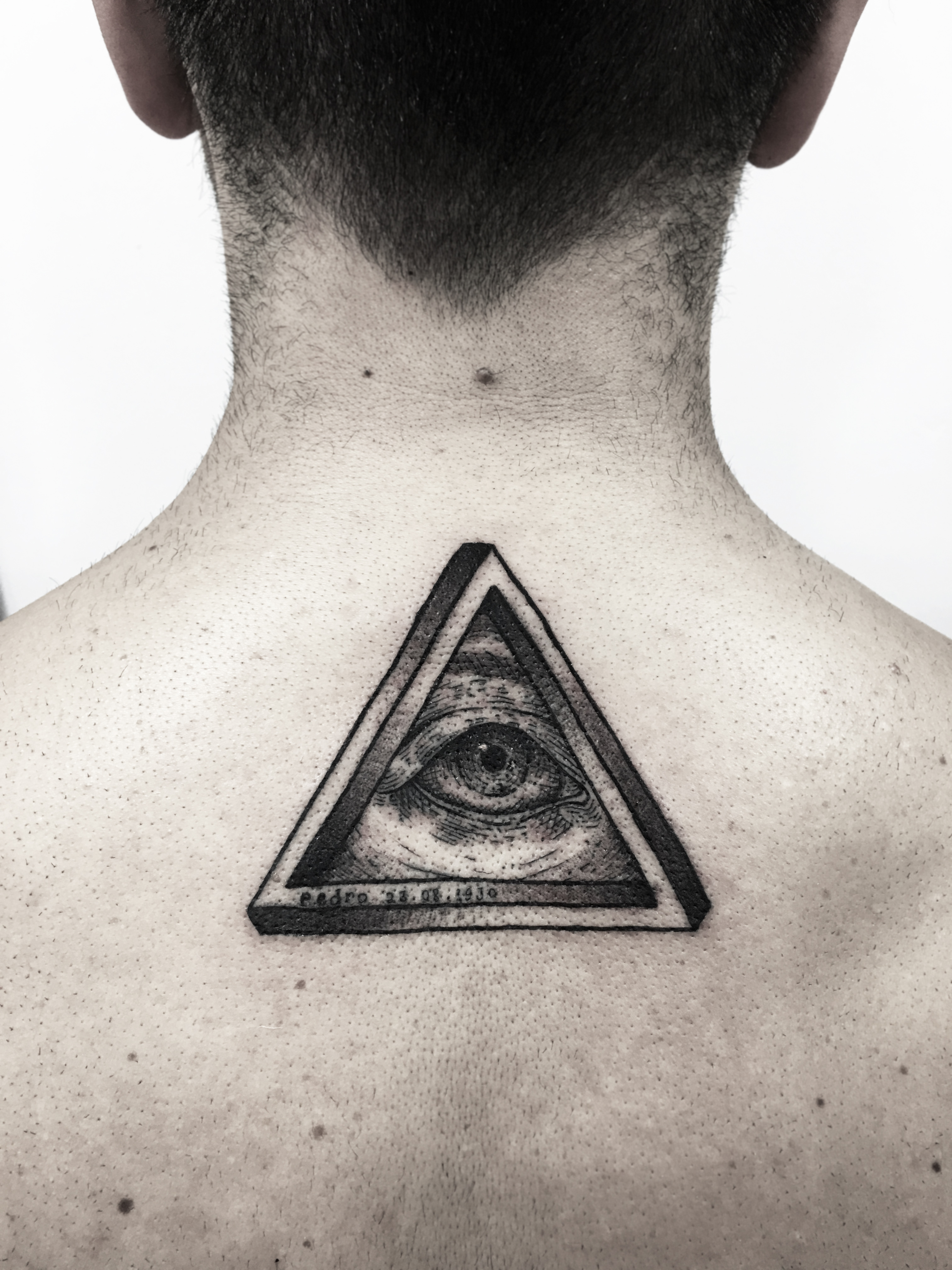 Eye