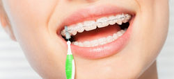 como_lavarse_los_dientes_con_brackets_co
