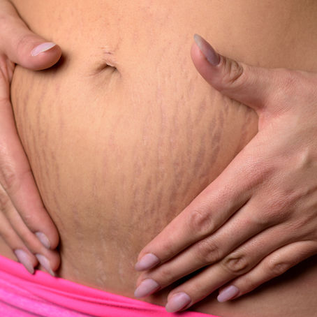 Your Postpartum Body, Love, and Everyone Else