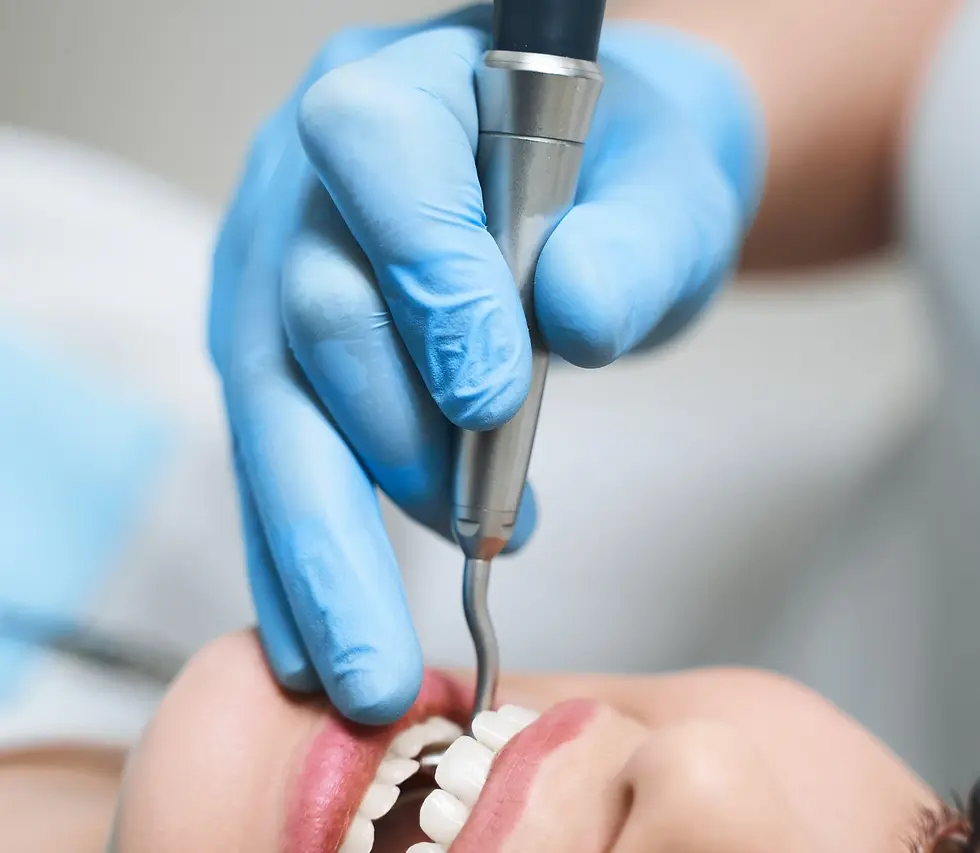 Affordable-gentle-root-canal-treatment-near-you-1